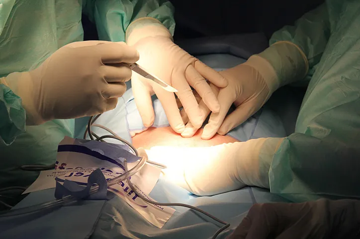 ¿Estás preparada para someterte a una intervención de Cirugía Estética?