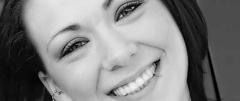 Prótesis faciales. Implantes de mentón y de pómulos en Sevilla