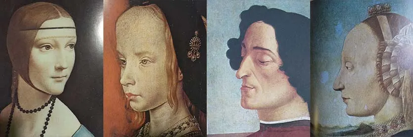 Rinoplastia antes y despues. ¿En qué consiste esta intervención?
